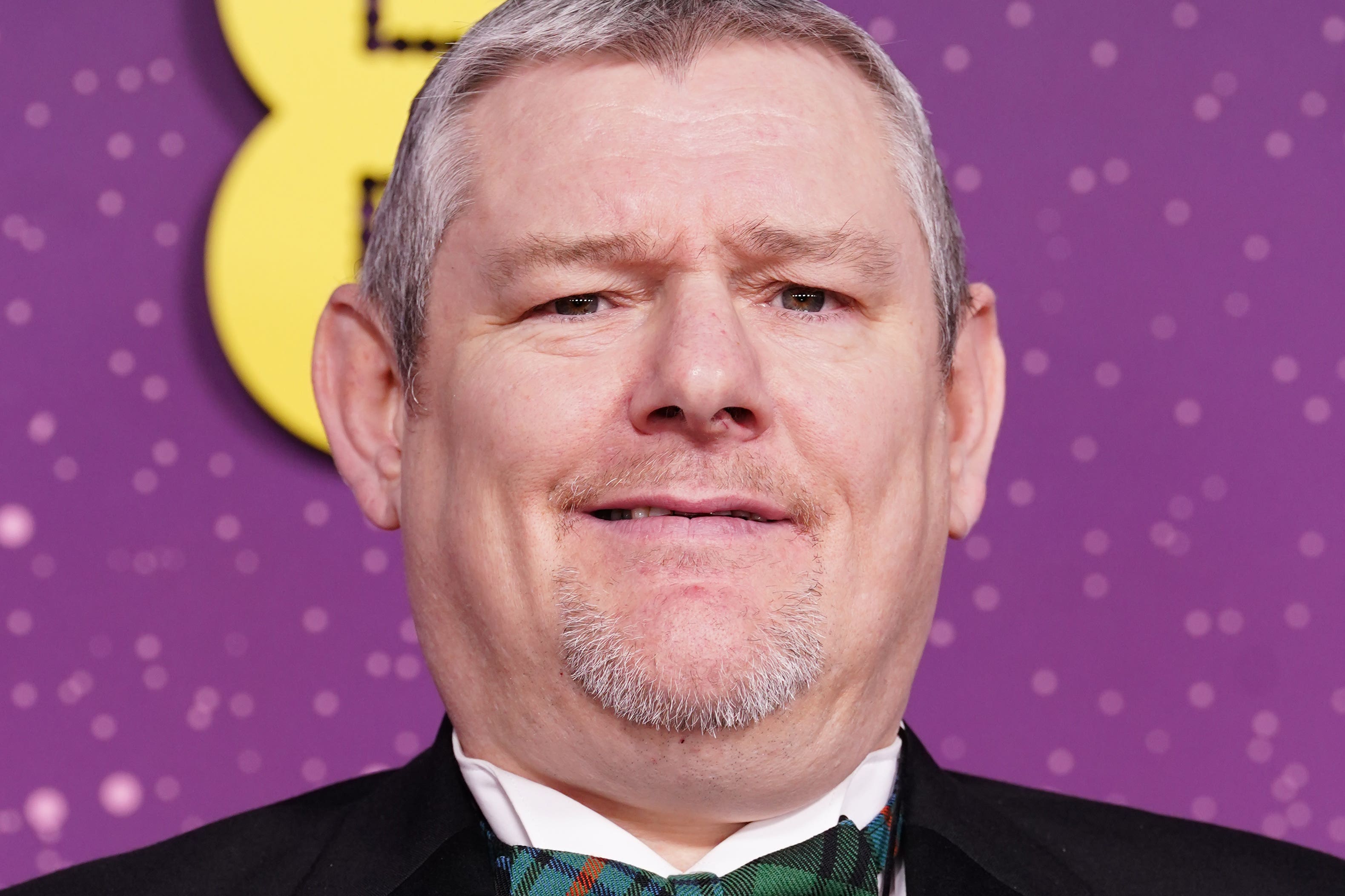 Tourette syndrome campaigner John Davidson shouted the slur during the Baftas on Sunday