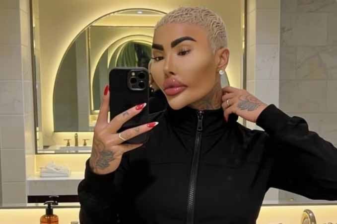 Jordan James Parke, dubbed the “British Lip King”, previously appeared on television shows including ITV’s This Morning to discuss cosmetic surgery he had previously undergone.