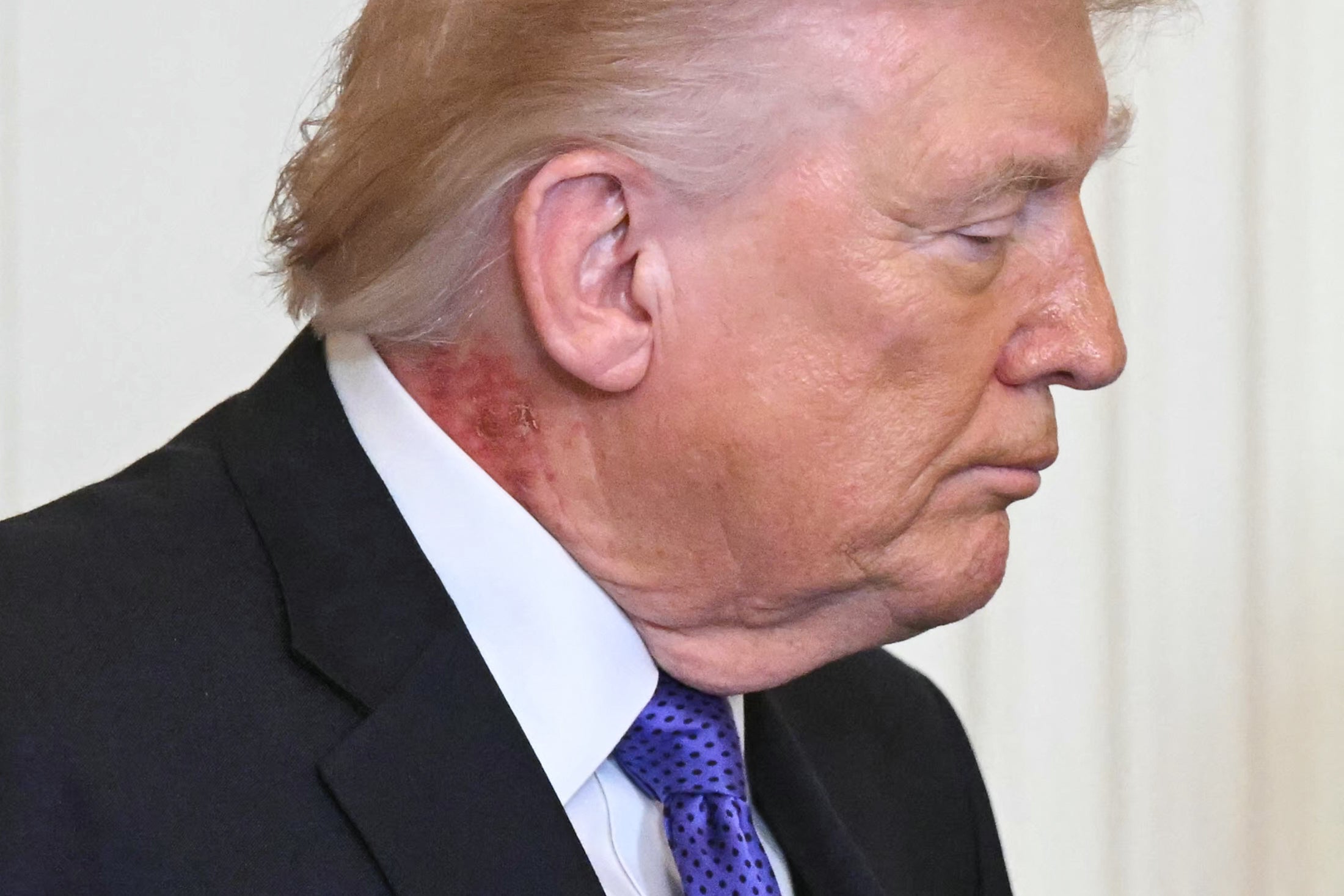 President Trump’s most recent medical report failed to mention why the president needed to use a skin cream for a preventative treatment in March