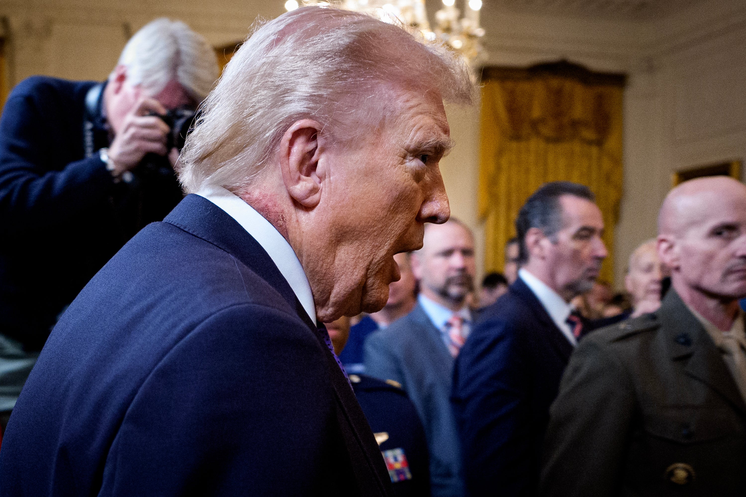 New questions over Trump&rsquo;s health as he appears with apparent rash on his neck