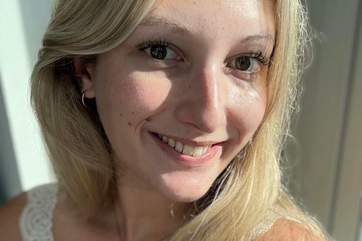 I thought my facial mole was harmless — until my doctor warned it could be skin cancer – UK Times I thought my facial mole was harmless — until my doctor warned it could be skin cancer – UK Times