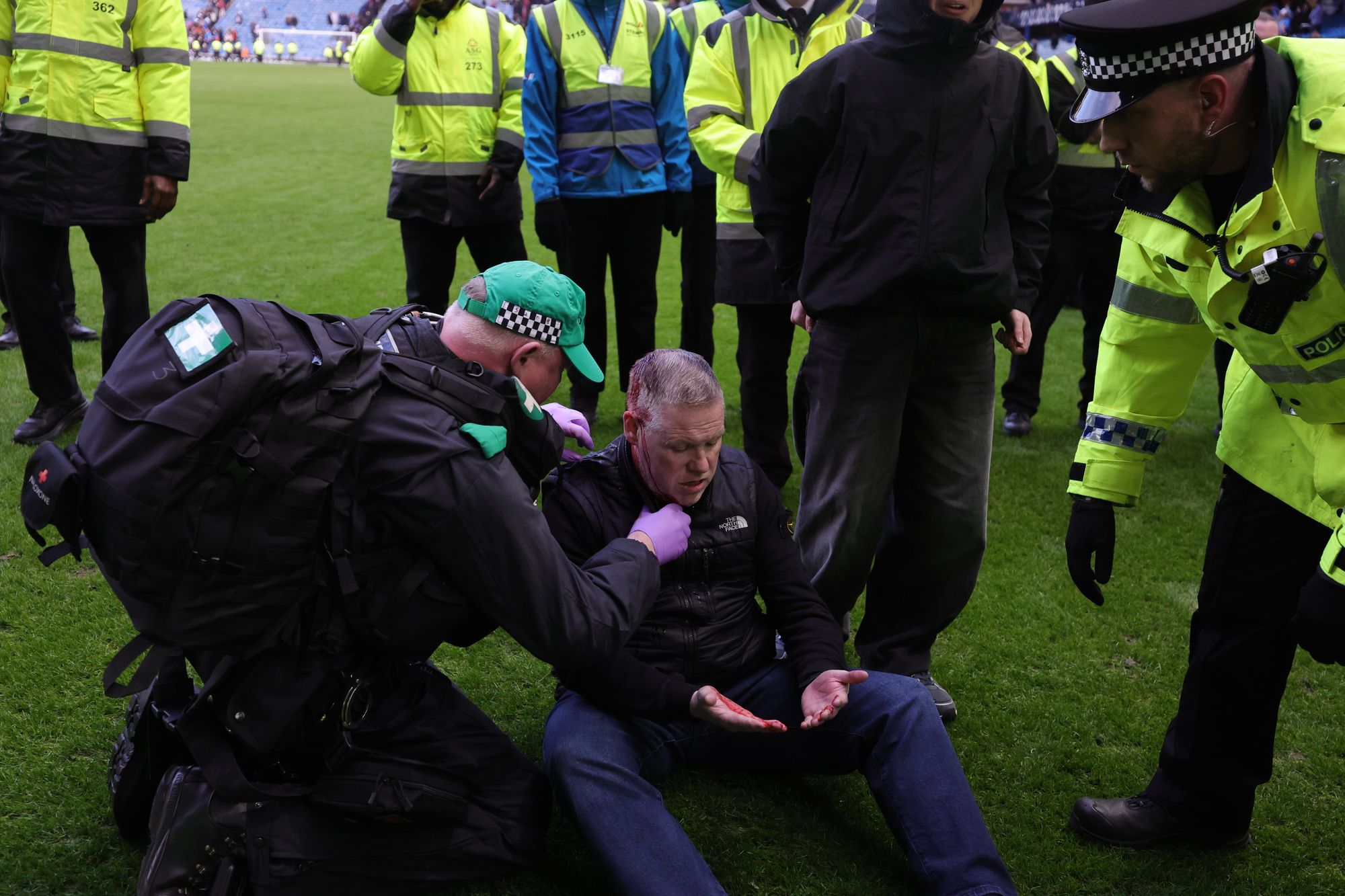 An injured man received medical attention on the pitch