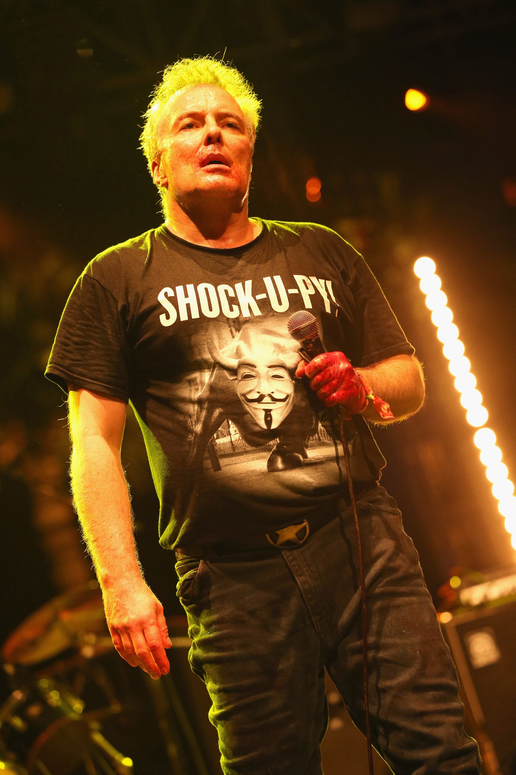 Dead Kennedys frontman Jello Biafra hospitalized after hemorrhagic stroke