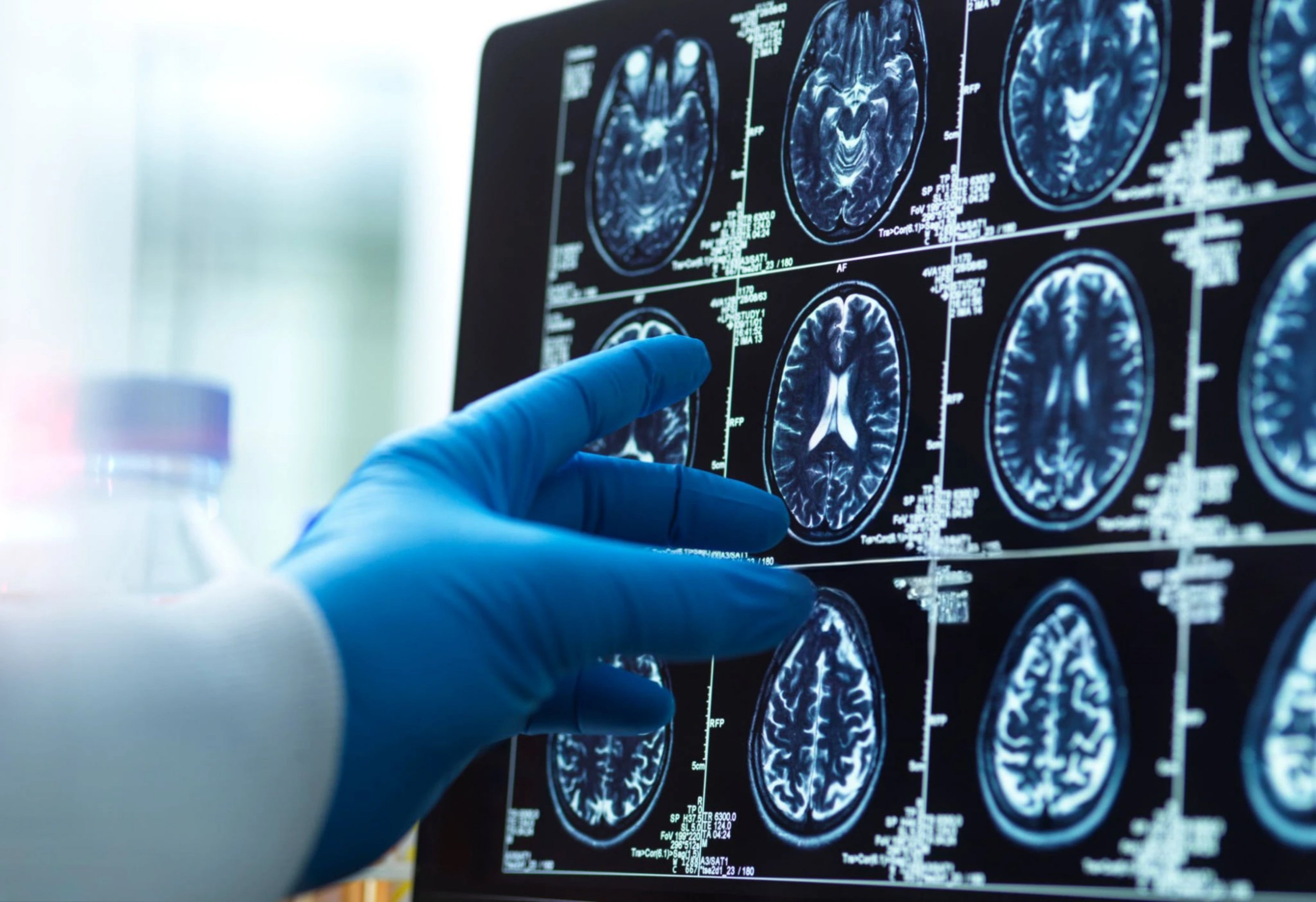 From Belly Fat To High Blood Pressure, This Common Condition Could Be Making Your Brain Older Than You Are