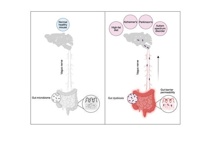 This graphic shows how gut bacteria travels to the brain using the vagus nerve in mice eating a high fat diet compared to healthy mice (left)