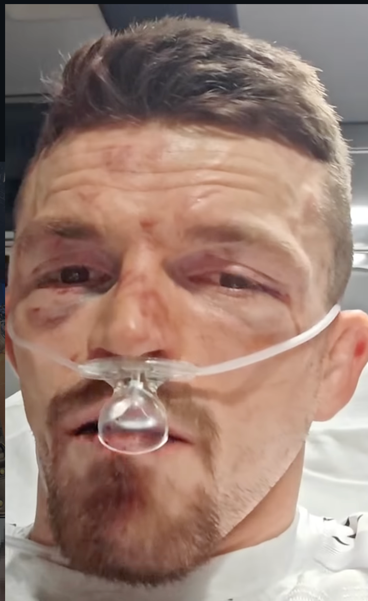 Harry Hardwick en route to hospital with a broken jaw