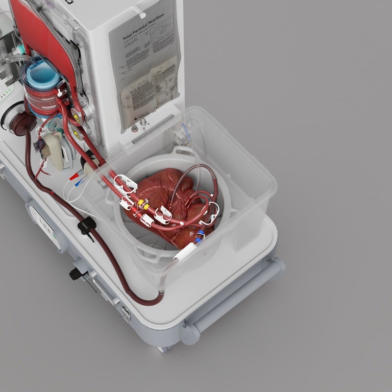 Perfusion is a technique for circulating oxygenated blood or nutrient-rich fluids through organs, preserving their function and enabling more time for them to be assessed