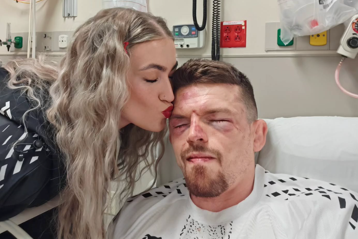 Harry Hardwick: British UFC star shares grisly video with broken jaw after brutal loss – UK Times Harry Hardwick: British UFC star shares grisly video with broken jaw after brutal loss – UK Times