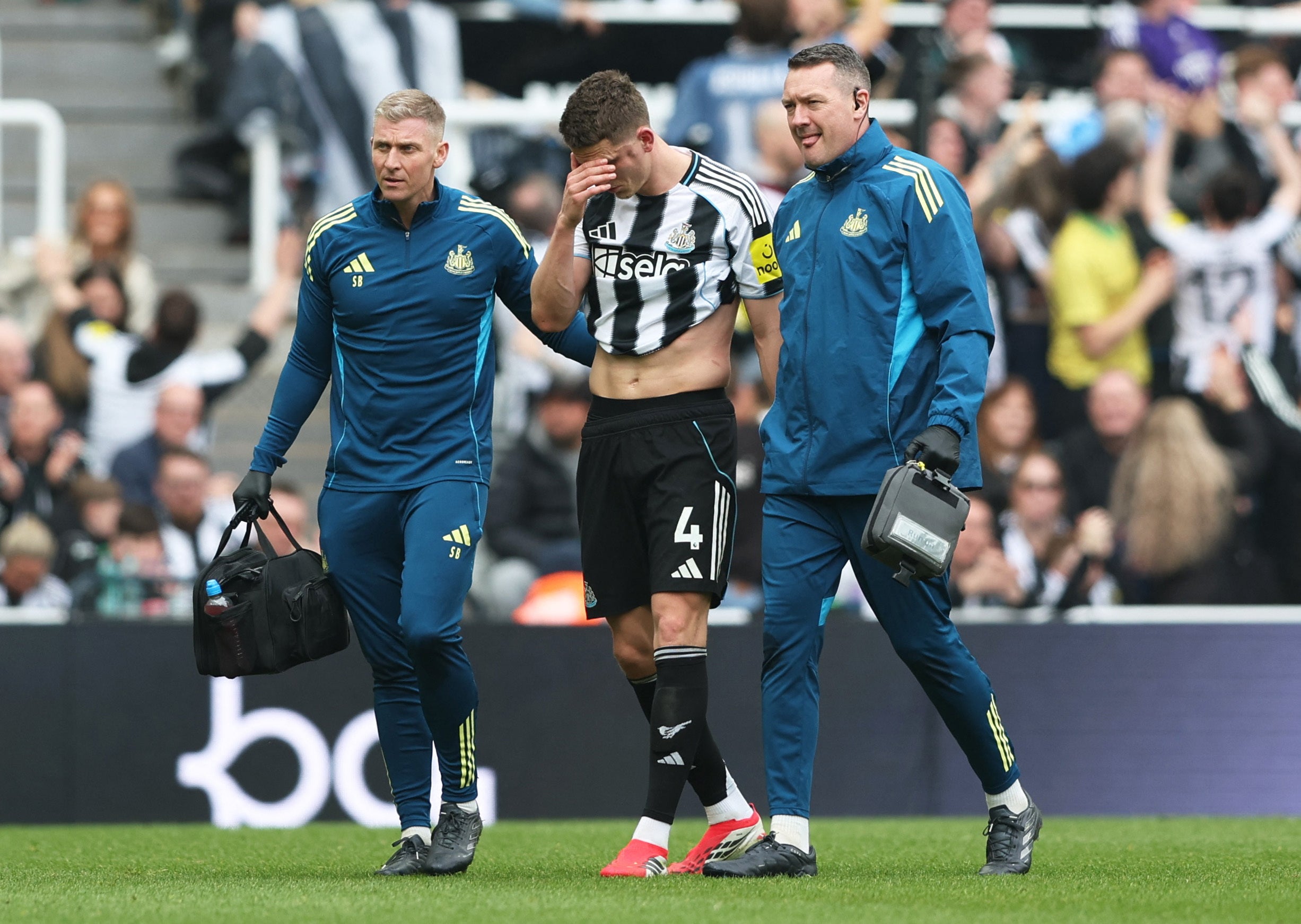Newcastle star has surgery after suffering facial fracture in loss to ...