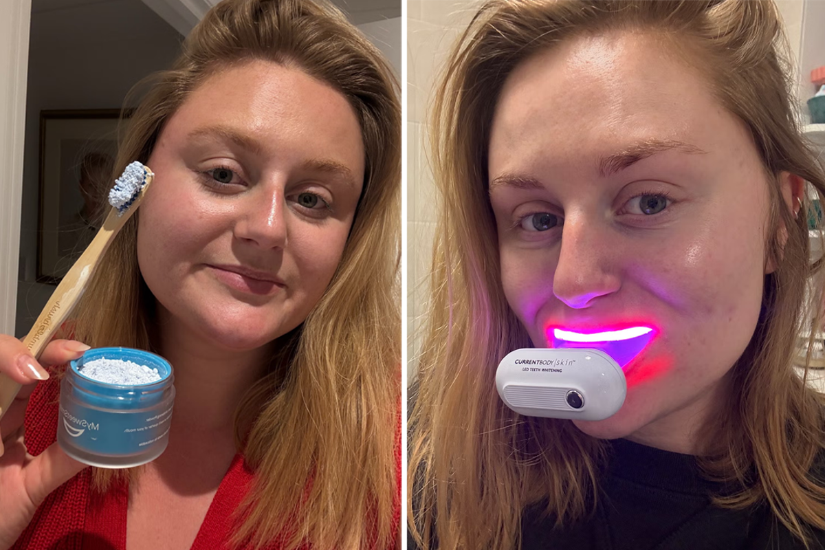 10 best teeth whitening kits, expert-tested to reverse staining
