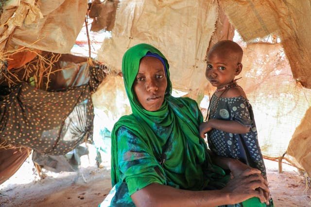 SOMALIA-DESNUTRICIÓN INFANTIL