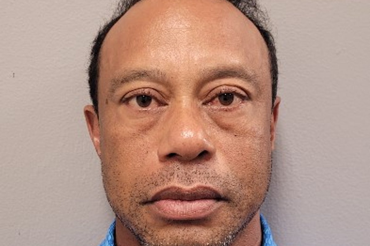 Tiger Woods to ‘step away and seek treatment’ in first public statement since car crash – UK Times Tiger Woods to ‘step away and seek treatment’ in first public statement since car crash – UK Times