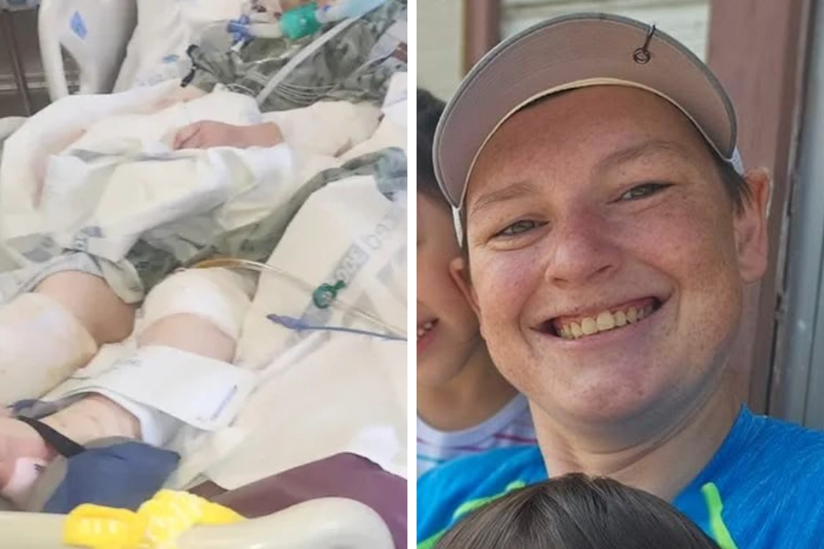 Mom, 38, undergoes multiple surgeries after being savagely mauled by unknown animal Mom, 38, undergoes multiple surgeries after being savagely mauled by unknown animal