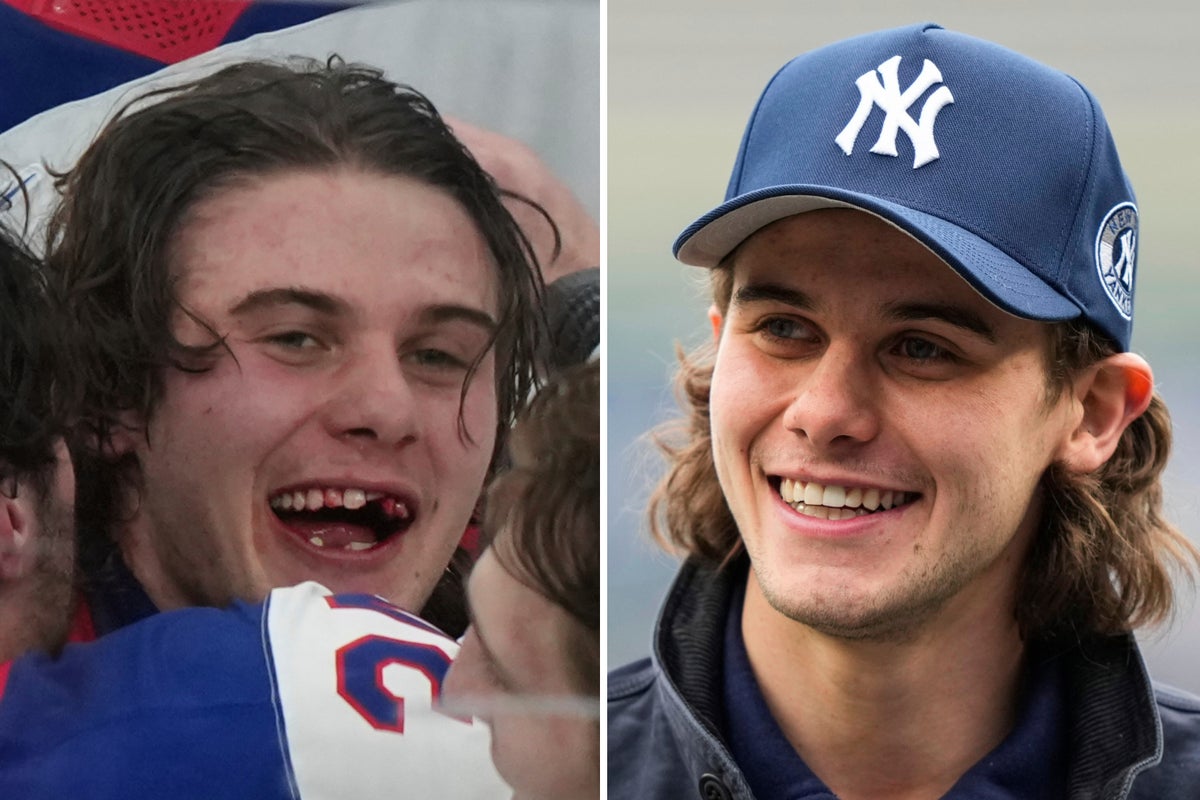 Jack Hughes Olympic golden goal is a reminder of how important hockey dentists are in the sport