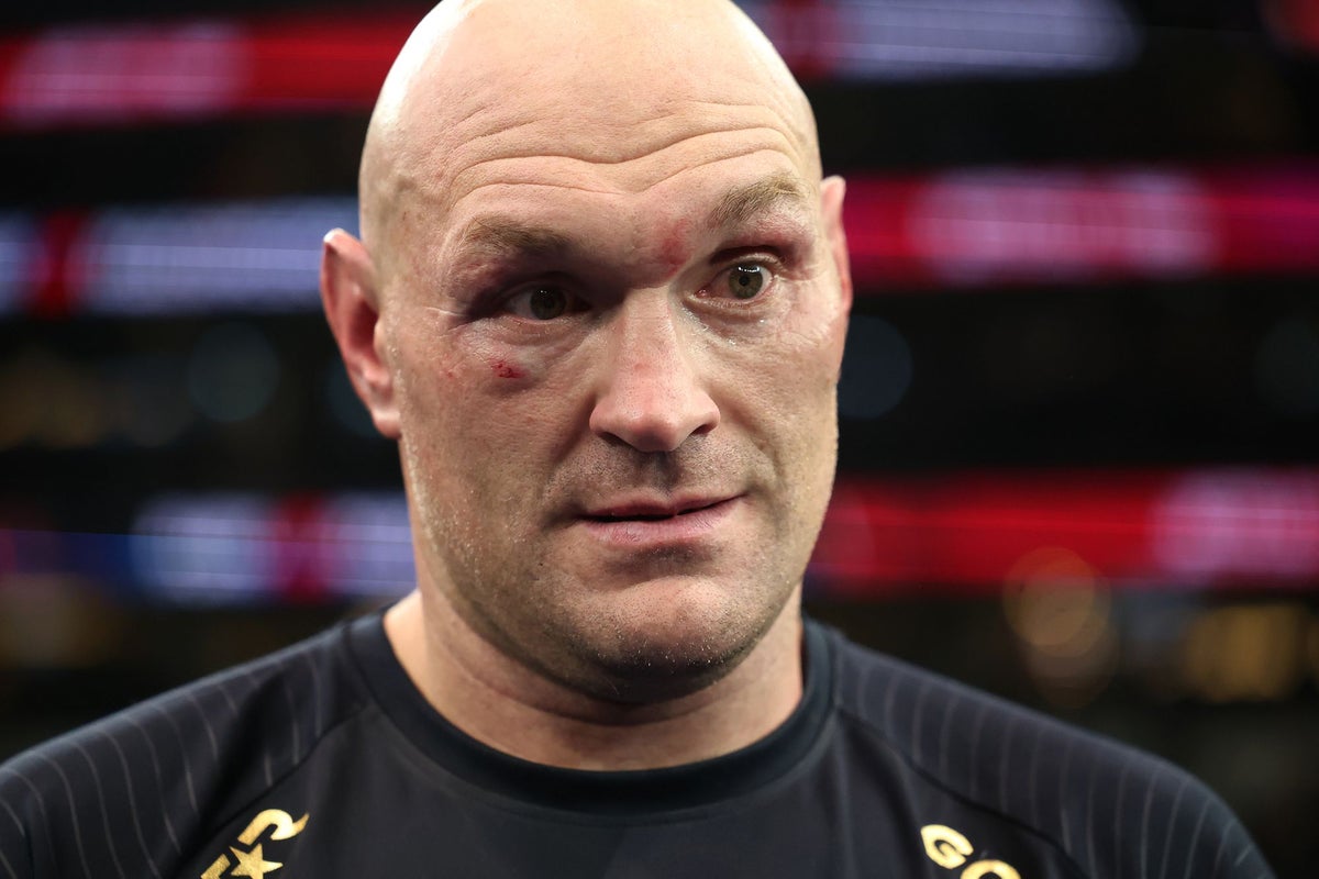 Tyson Fury returns with vulnerability and teaches Anthony Joshua a valuable lesson – UK Times Tyson Fury returns with vulnerability and teaches Anthony Joshua a valuable lesson – UK Times