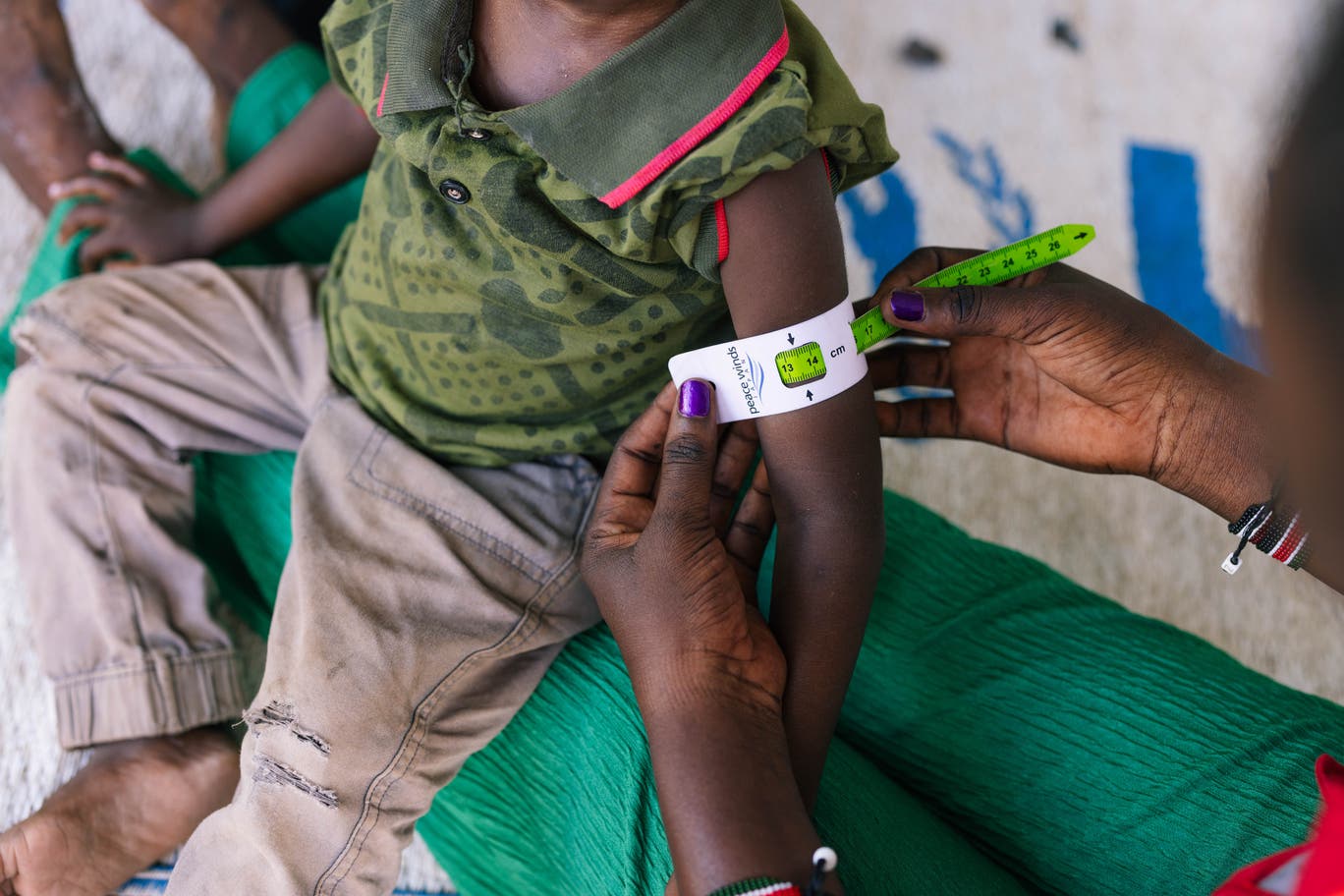 A child's upper arm during a routine home visit to assess for malnutrition inside the Kalobeyei refugee settlement