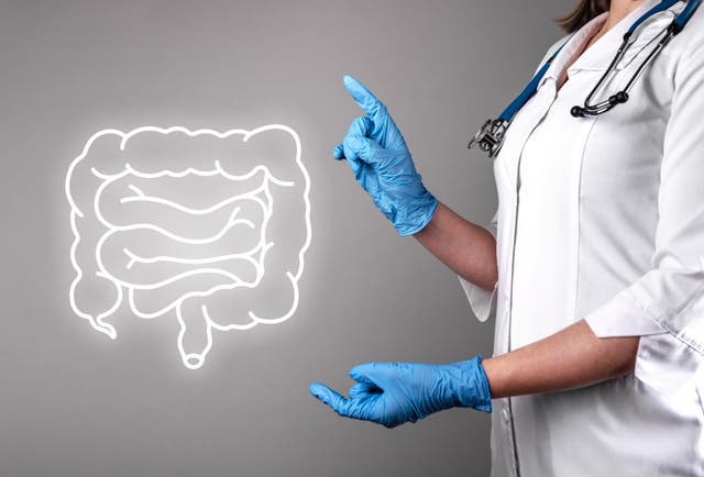 Early-onset bowel cancer has increased globally since 1990 say experts