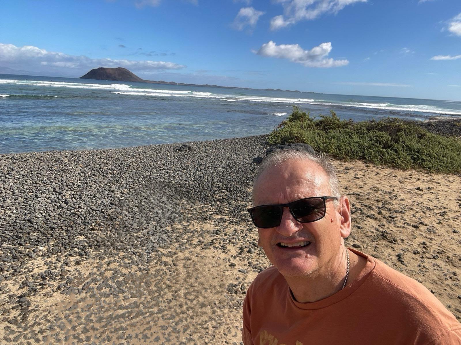 He underwent aquablation therapy at 66