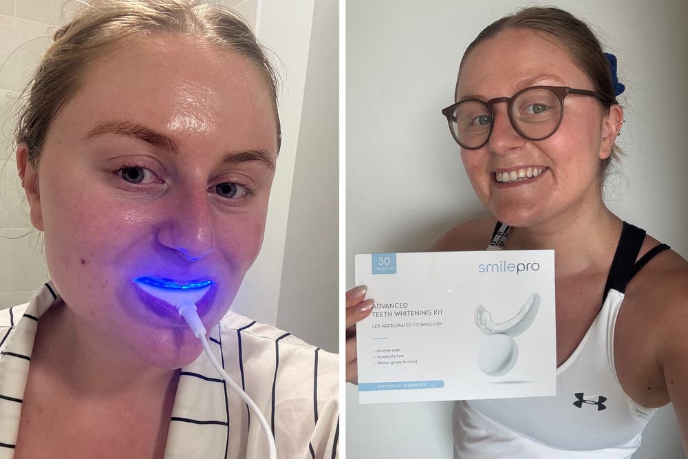Best teeth whitening kits 2026, expert-tested for stain removal | The ...