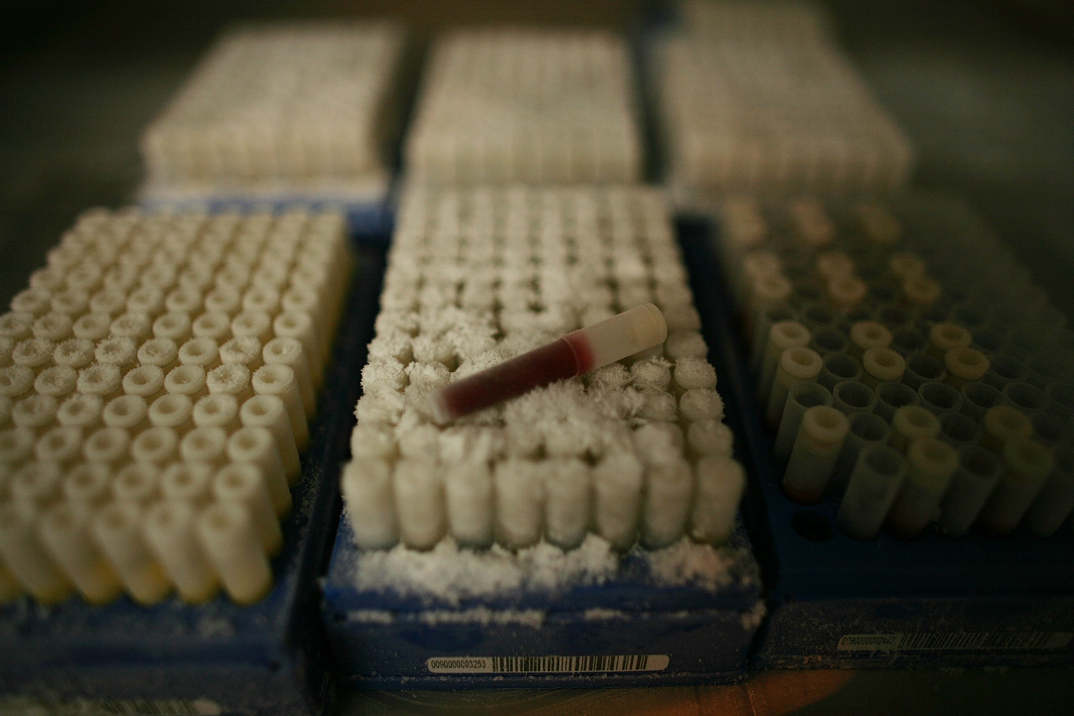Blood samples taken from volunteers, ready to be stored in the UK Biobank