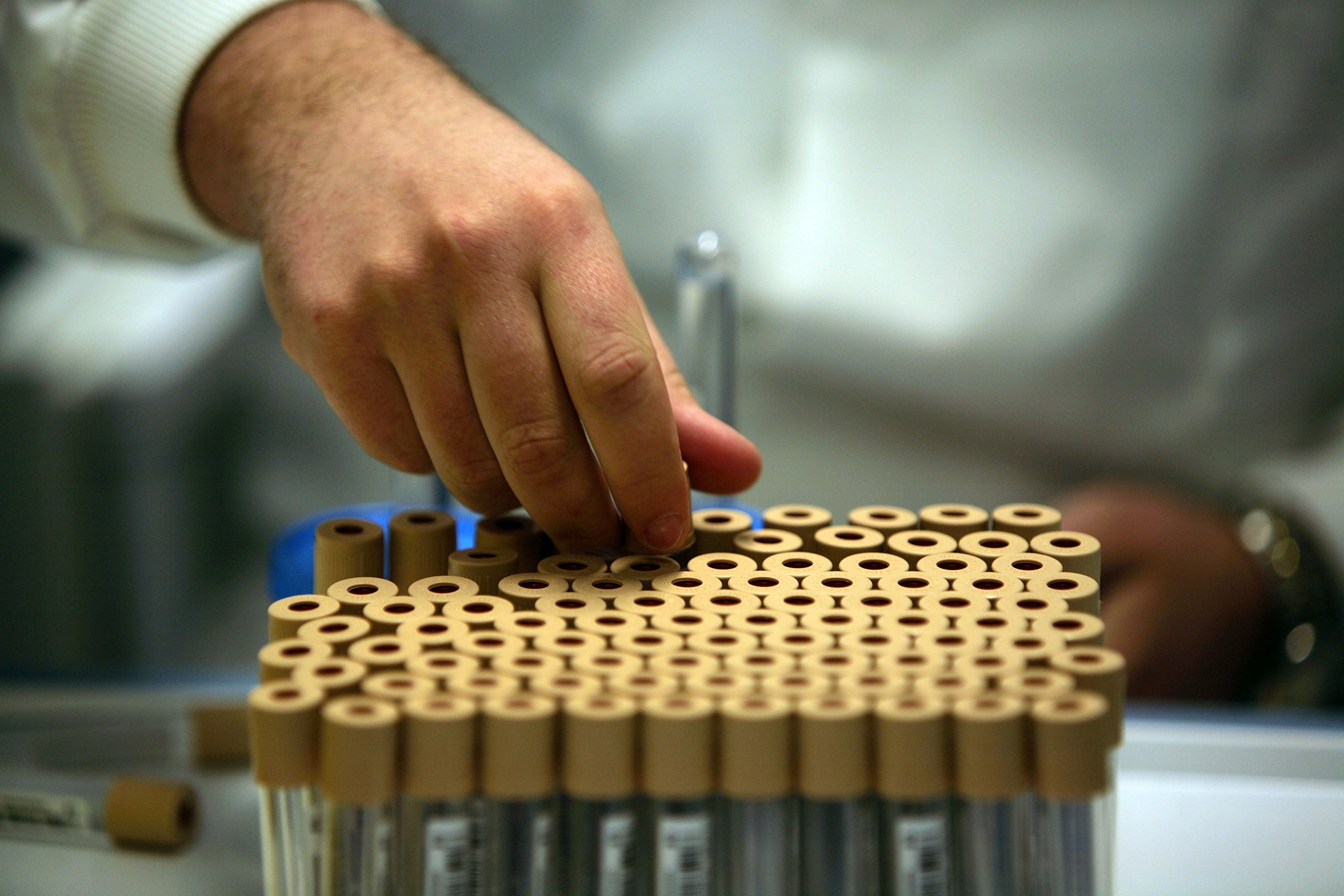Blood samples taken from volunteers are labelled and ready to be stored in the UK Biobank which will hold up to 15 million urine and blood samples