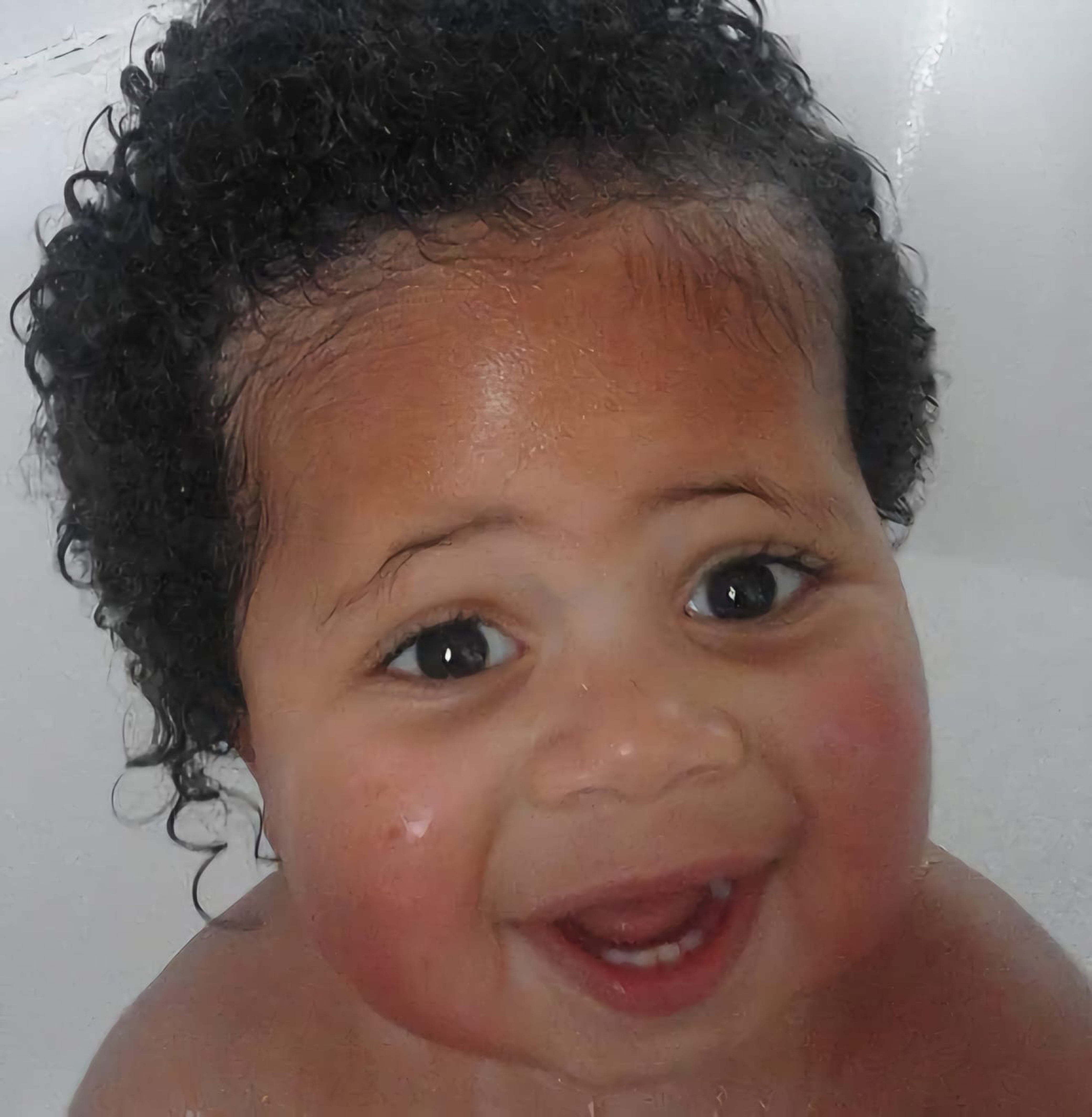 Theo Kempthorne was born with hydrocephalus, a buildup of fluid in the brain