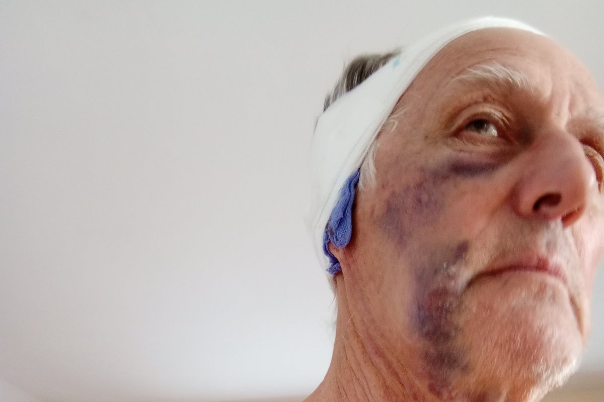 Carpenter Christopher Wellman fractures pensioner Colin Prior’s eye socket with piece of wood as Dorset neighbourhood dispute erupts – UK Times Carpenter Christopher Wellman fractures pensioner Colin Prior’s eye socket with piece of wood as Dorset neighbourhood dispute erupts – UK Times