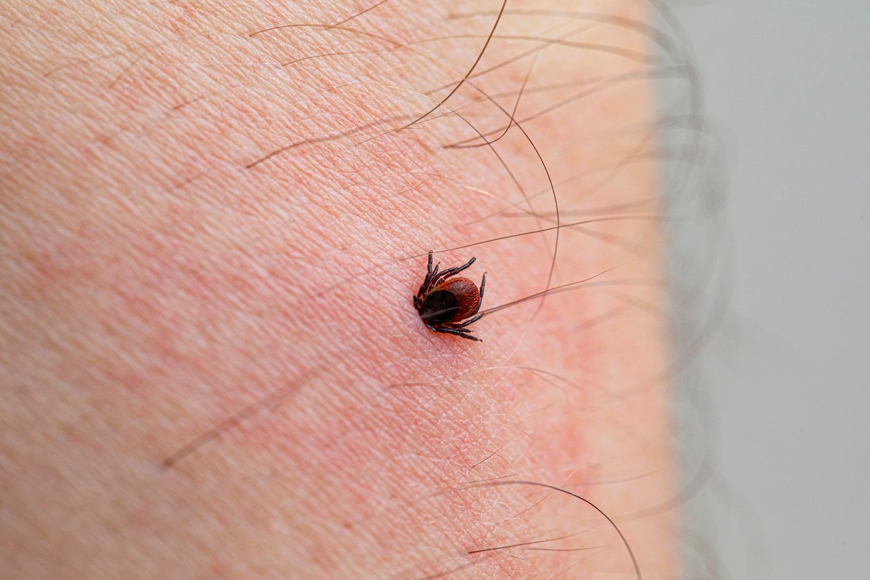 Lyme disease can be tricky because people often don’t notice tick bites and may overlook early symptoms of an infection