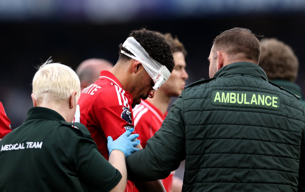 Morgan Gibbs-White could wear face mask for Europa League semi-final after suffering nasty injury
