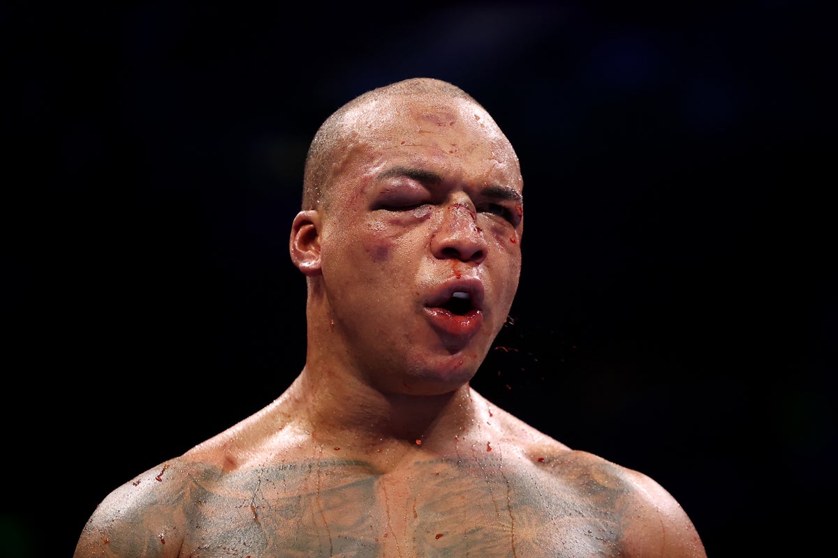 Was Wardley vs Dubois stopped too late? Bloody duel reveals controversial truth – UK Times Was Wardley vs Dubois stopped too late? Bloody duel reveals controversial truth – UK Times