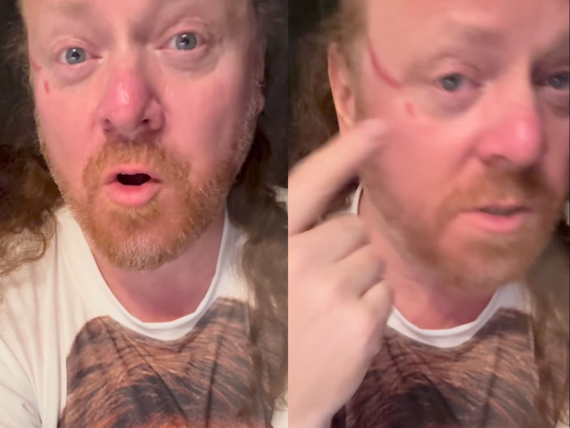 Keith Lemon actor Leigh Francis clawed in face by overzealous fan during DJ set