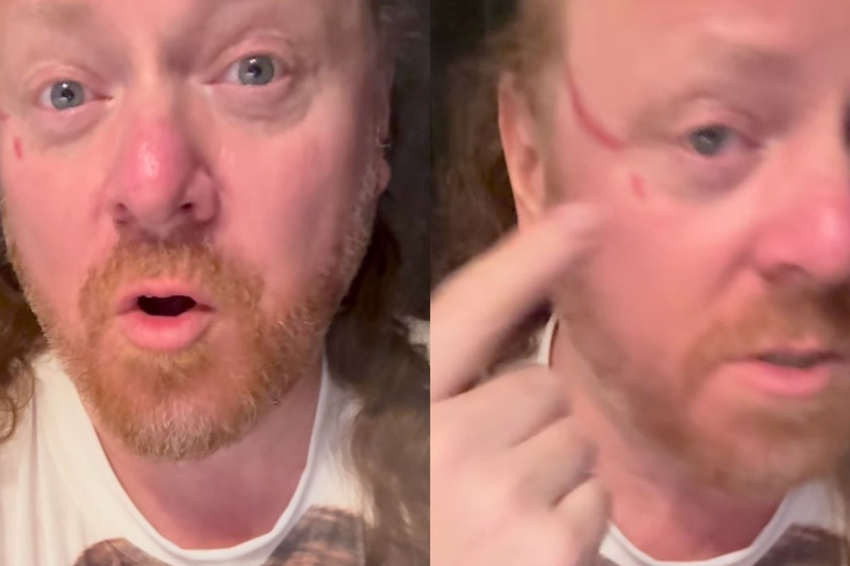 Keith Lemon actor Leigh Francis clawed in face by overzealous fan during DJ set Keith Lemon actor Leigh Francis clawed in face by overzealous fan during DJ set