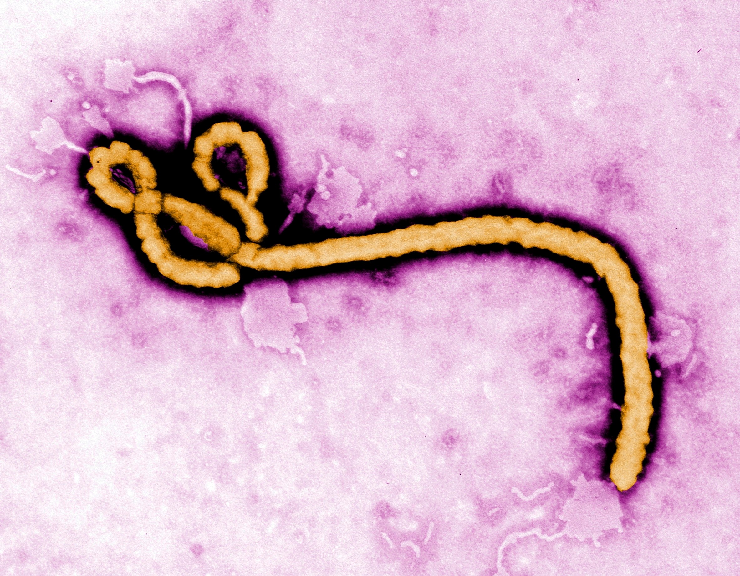 A colourised transmission electron micrograph file image made available by the Centers for Disease Control and Prevention (CDC) shows an Ebola virus virion