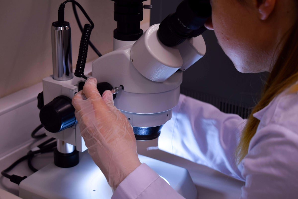 New cell therapy offers ‘real hope’ for liver disease patients – UK Times New cell therapy offers ‘real hope’ for liver disease patients – UK Times