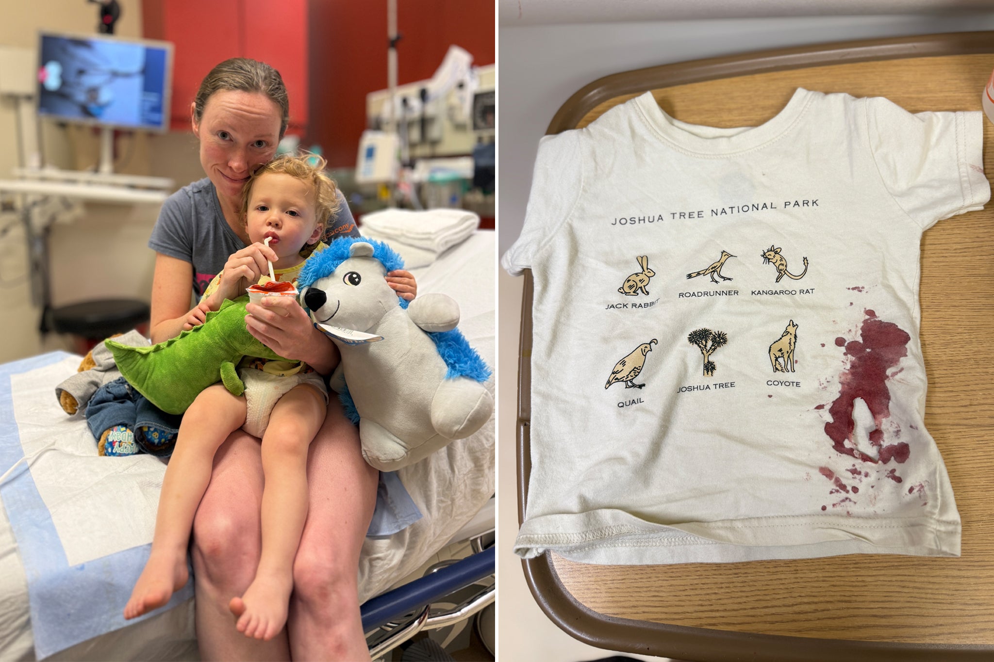 2-year-old left needing stitches and rabies shot after being attacked by a raccoon at Massachusetts playground: &lsquo;It happened so fast&rsquo;