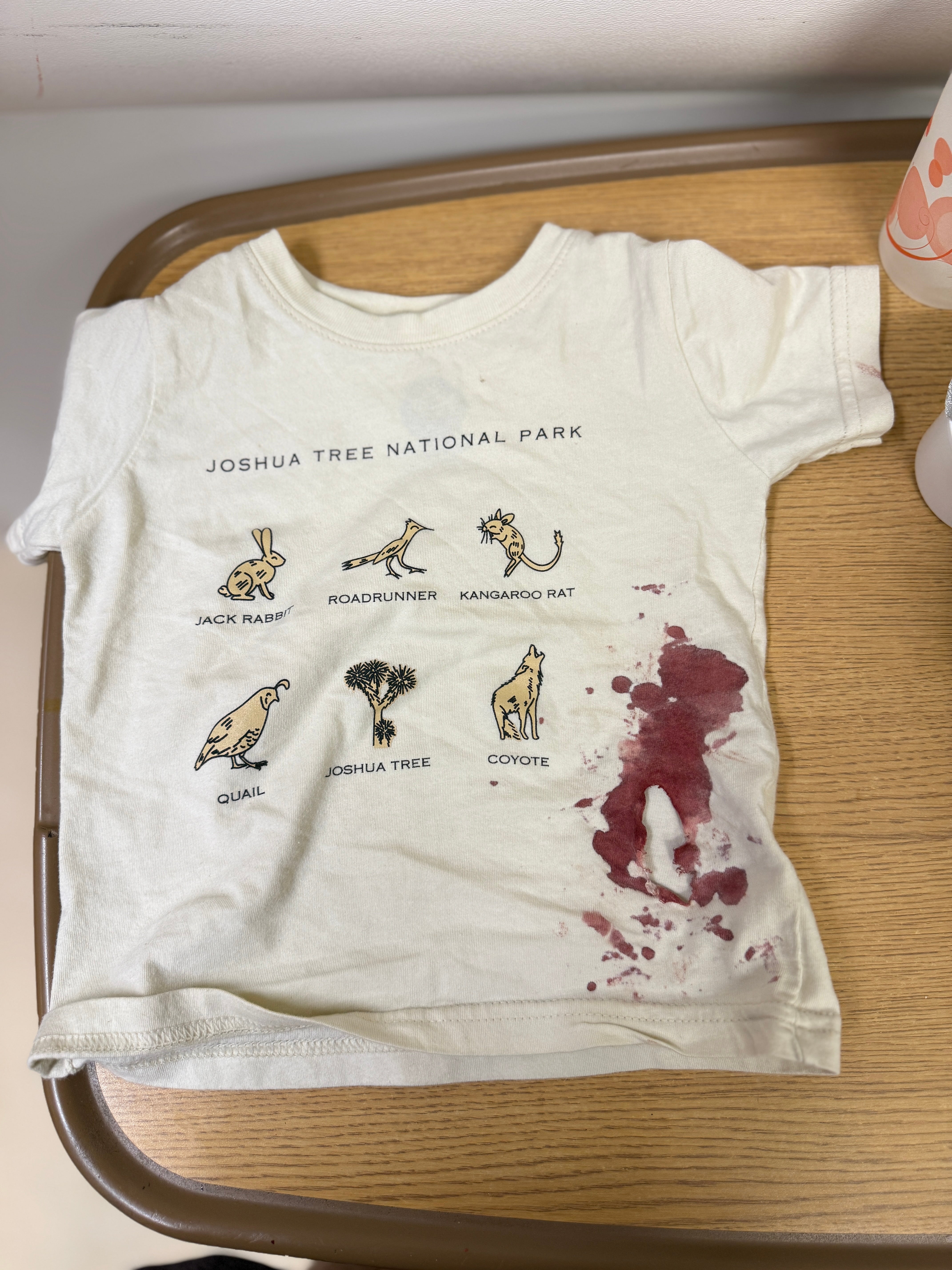The two-year-old was left with a deep bite and multiple scratches across his rib cage