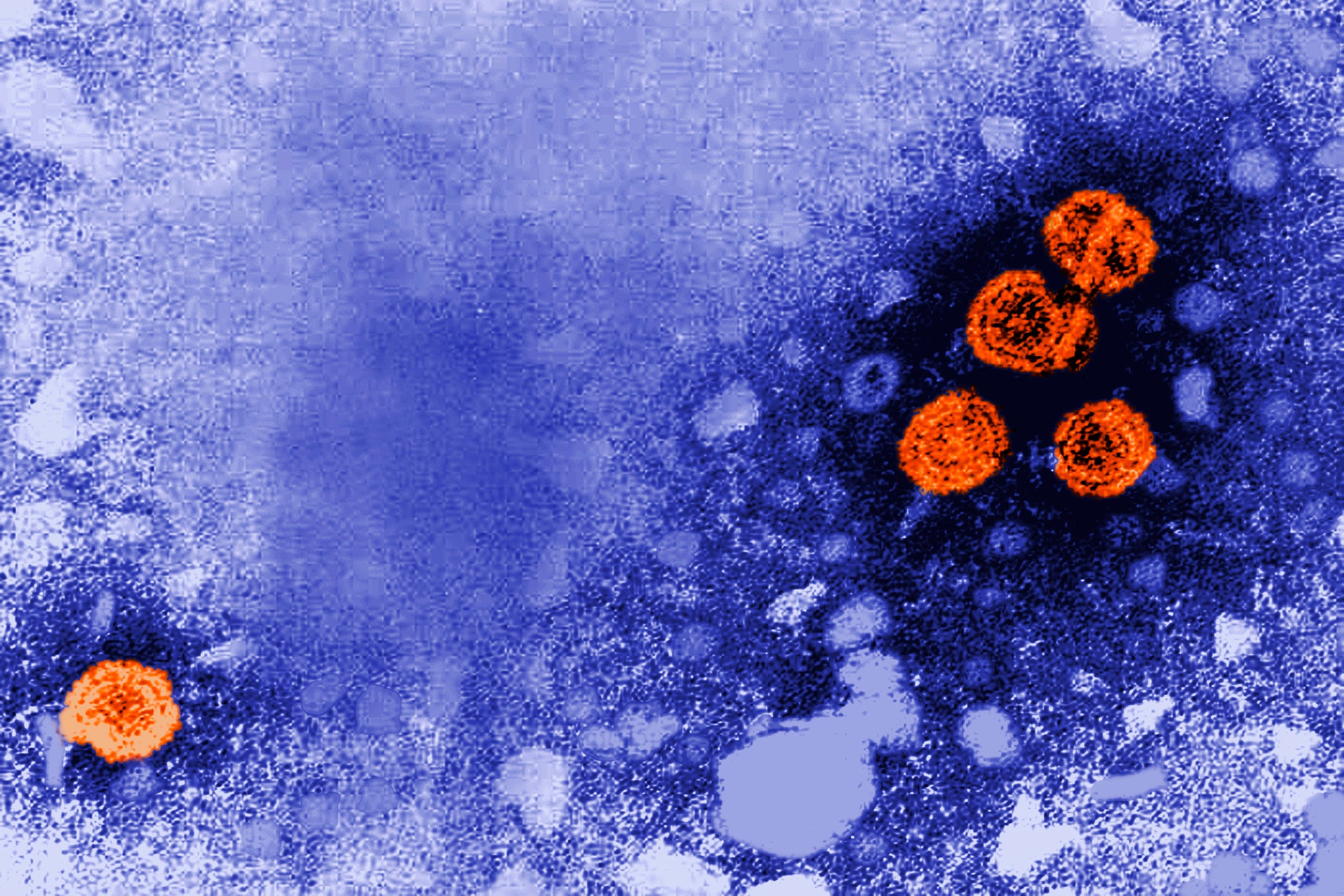 This 1981 electron microscope image made available by the U.S. Centers for Disease Control and Prevention shows hepatitis B virus particles, indicated in orange (CDC)