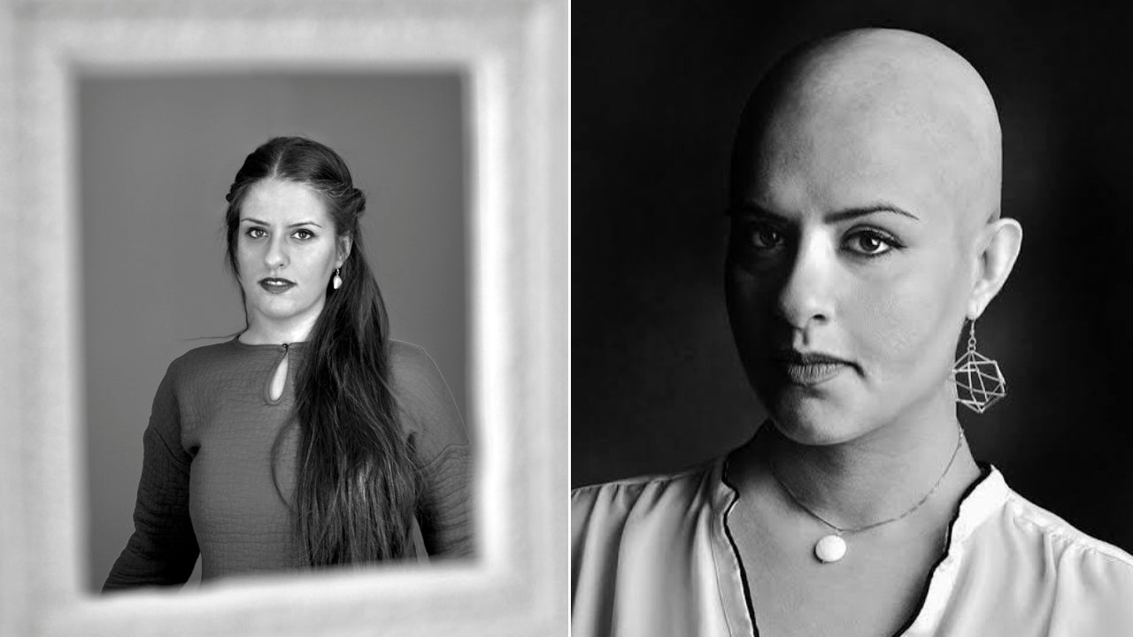 Tahmineh Monzavi spent a month in solitary confinement in 2012 and developed an autoimmune disease that caused her to go bald.