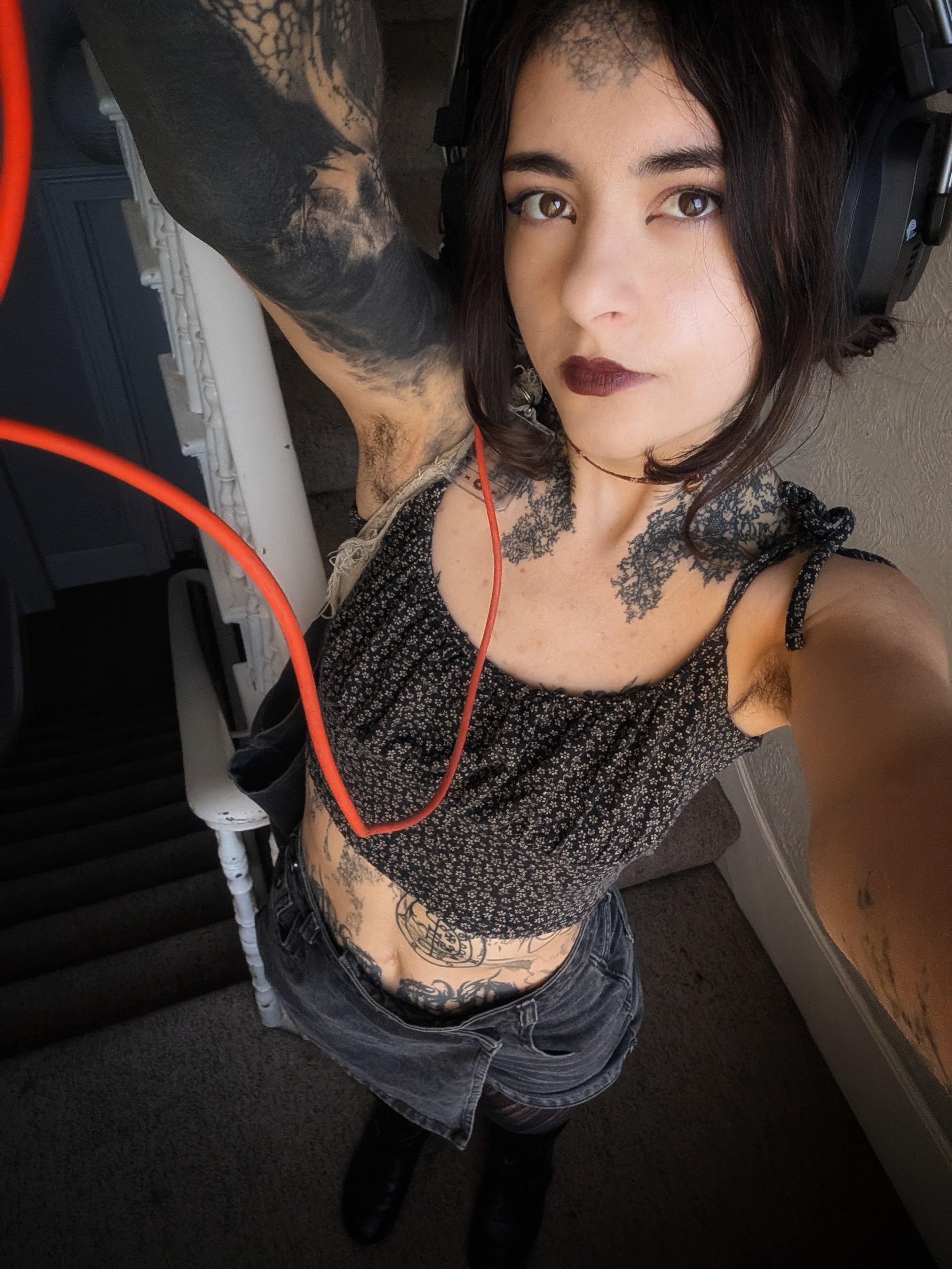 Ms Blackthorne was diagnosed with EDS at 21 and now also lives with extreme fatigue, swelling, skin rashes and mouth bleeding after speaking.