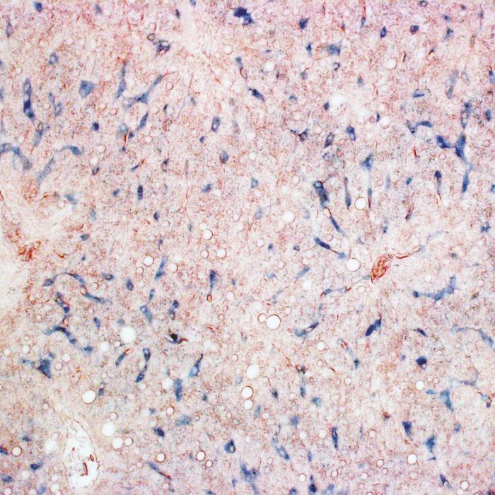 Pigeon liver tissue, depicting iron-containing macrophages (blue) (Lisowski et al. (2026) Science)