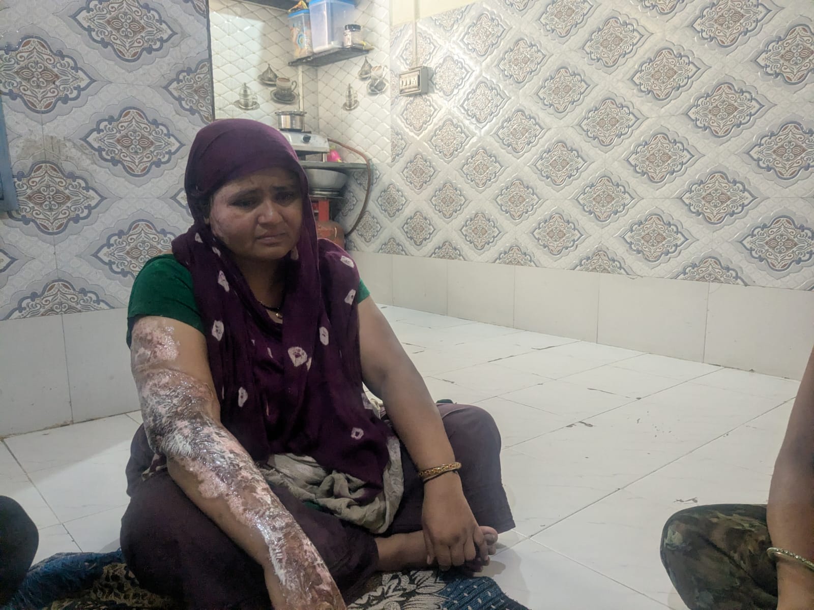 Sitaben Patni suffered severe burn injuries in the crash