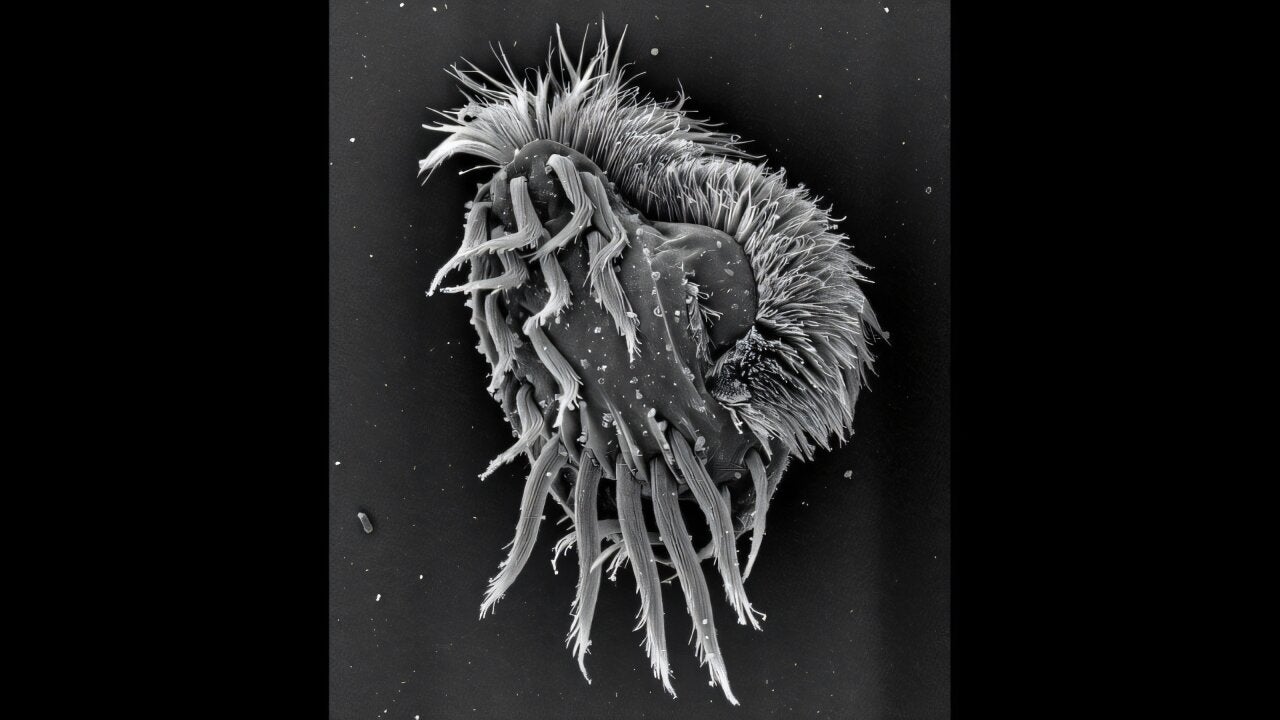 https://static.independent.co.uk/2026/06/04/9/00/Euplotes-gigatrox-cell-imaged-by-scanning-electron-microscopy-(SEM).jpeg?trim=0,100,0,100&width=1200&height=800&crop=1200:800