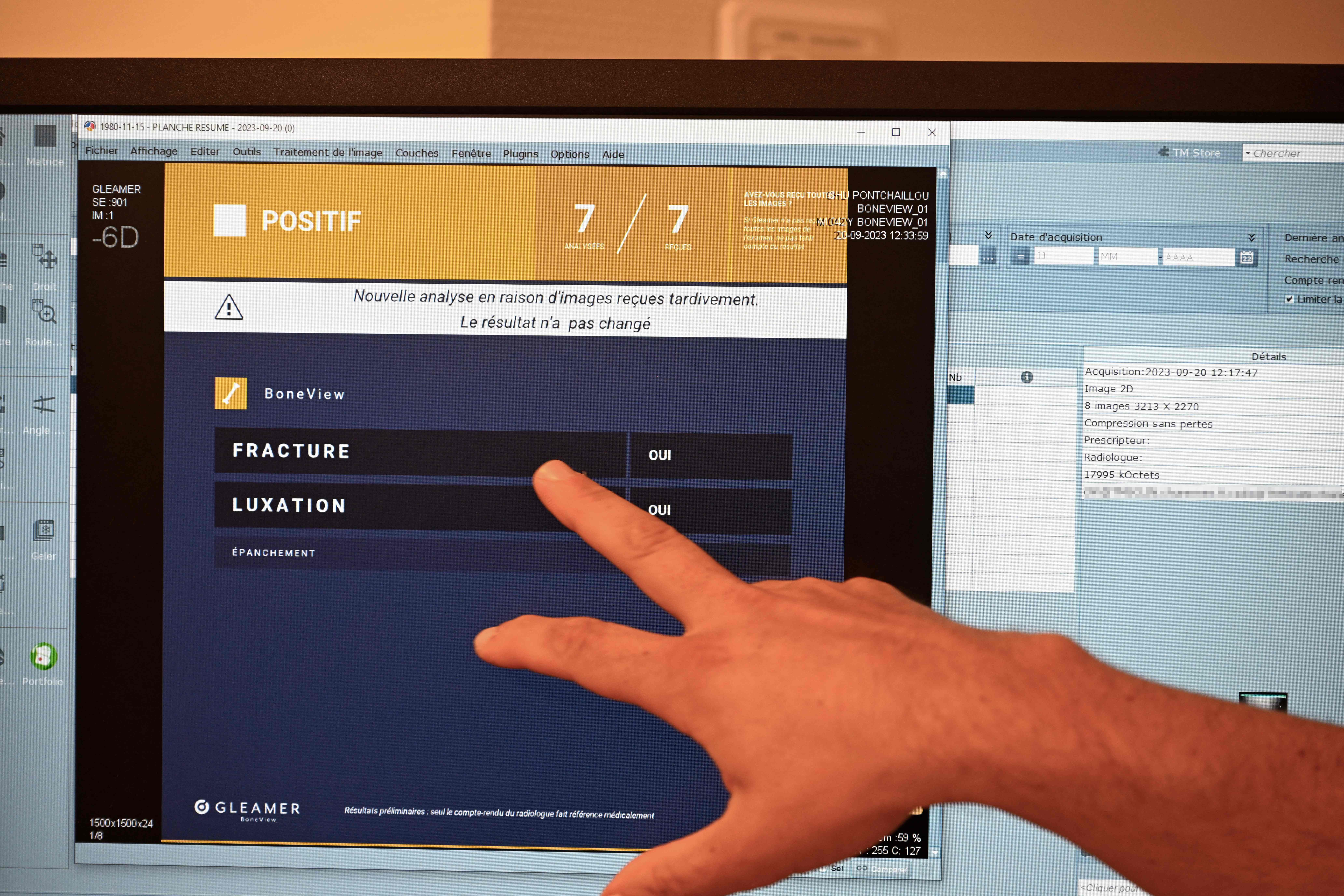 A doctor diagnoses a fracture with the help of AI (AFP/Getty)