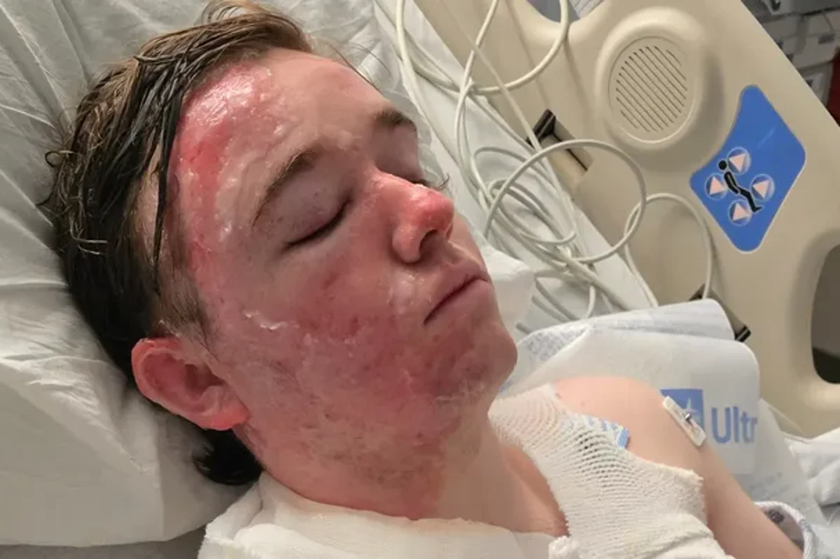 McDonald’s employee left in ‘excruciating’ pain wi