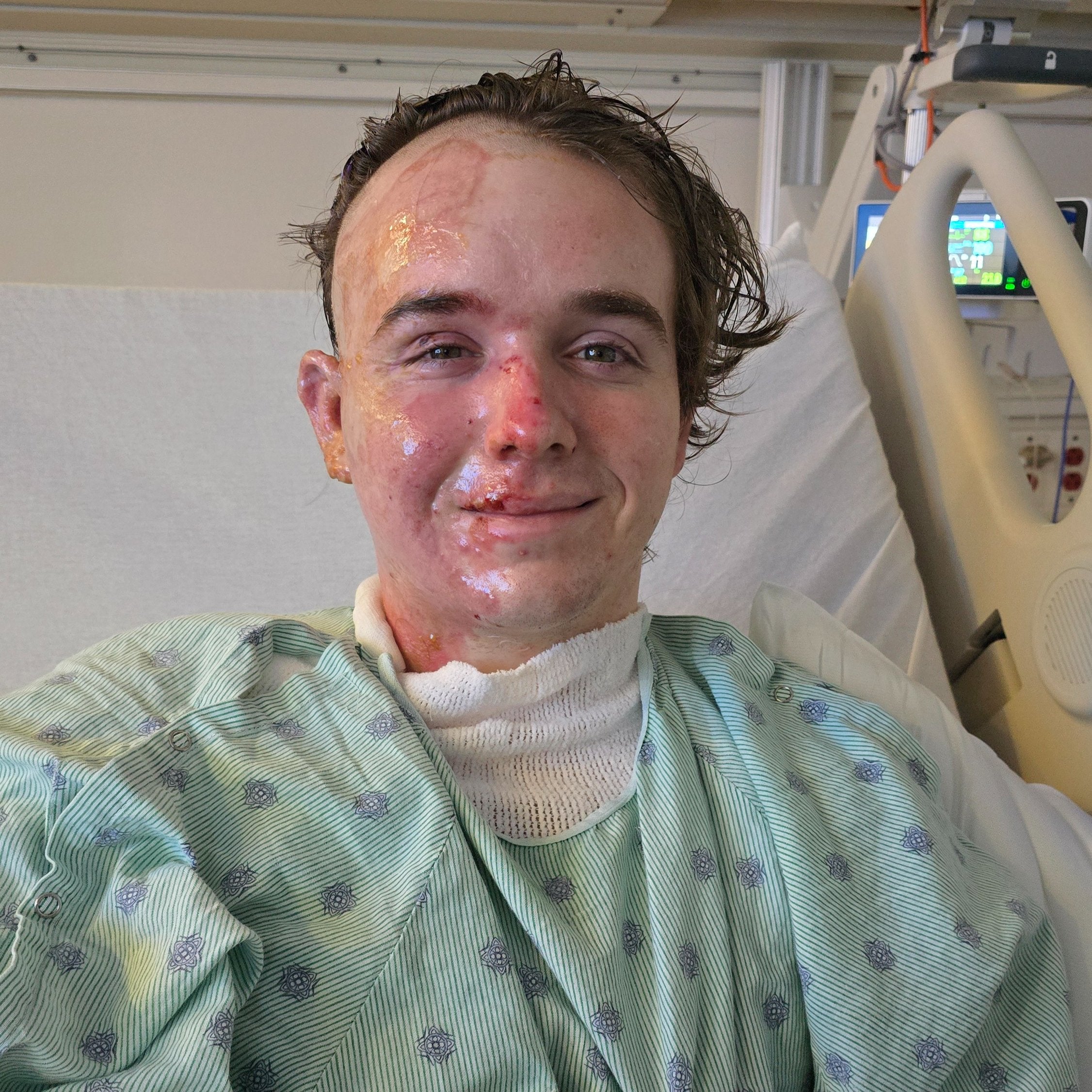 This unexpected tragedy has created a major setback at a time when he should be looking forward to building his life and planning his future,” Jacob Smith’s mom said. (GoFundMe)