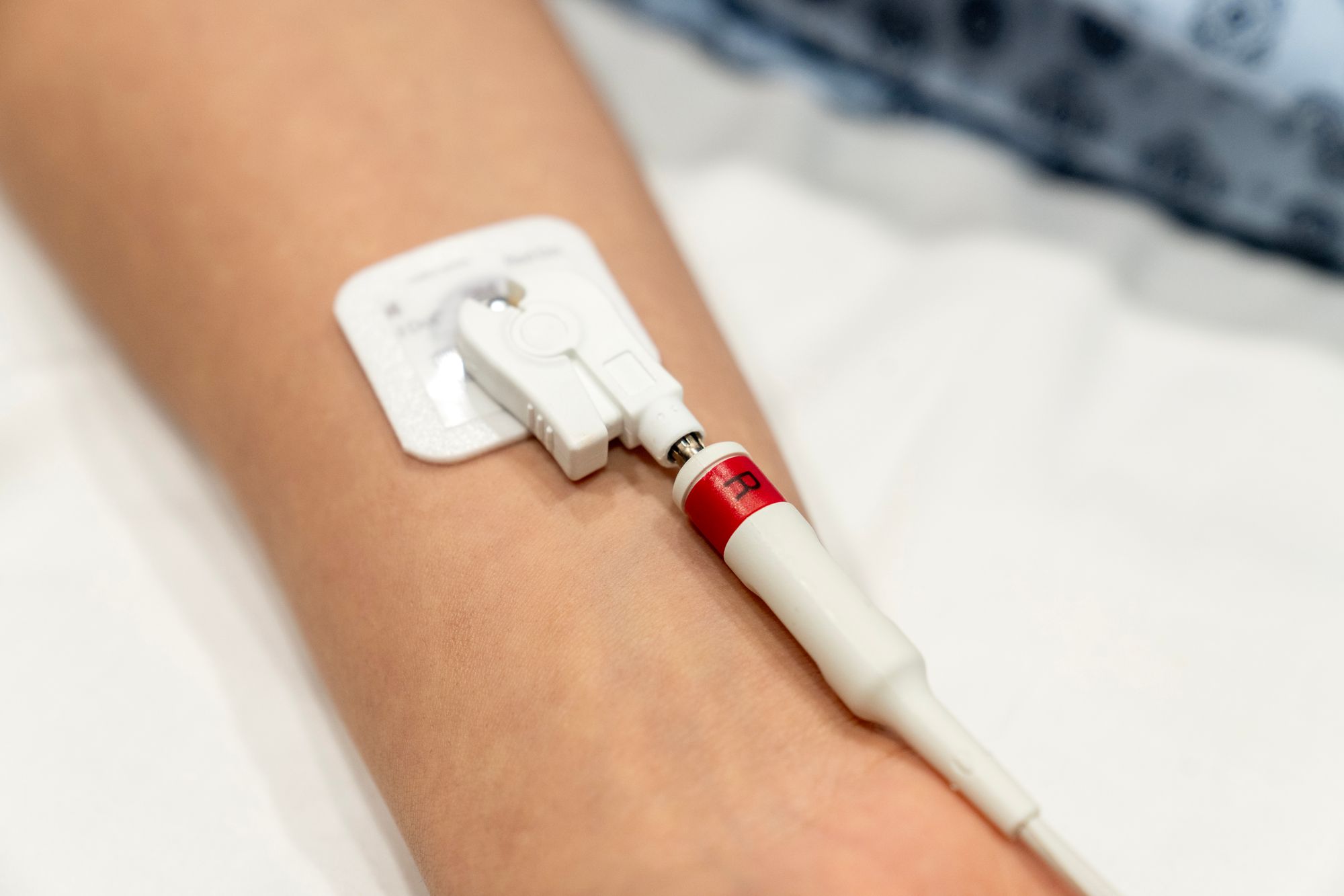 Despite your age, you can be referred for an ECG by a doctor, GP or healthcare provider