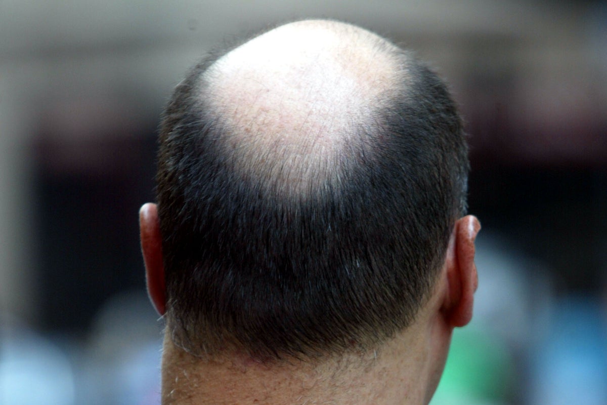 The ancient Chinese herb that transforms hair loss: ‘Studies