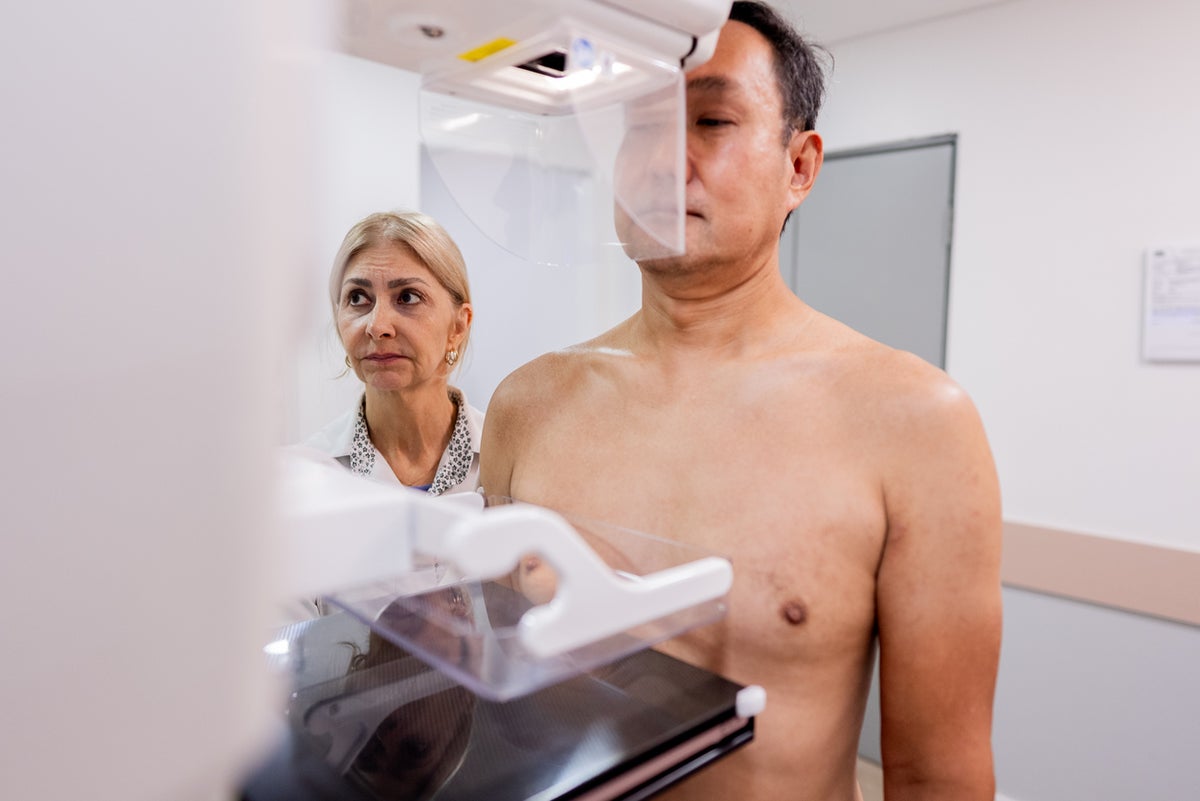 Yes, men can get breast cancer. Here’s how common 