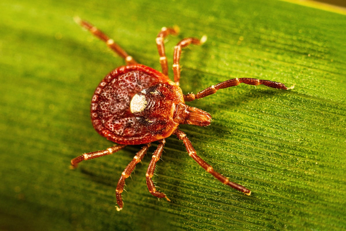What to know about alpha-gal syndrome, the life-threatening meat allergy caused by tick bites – UK Times What to know about alpha-gal syndrome, the life-threatening meat allergy caused by tick bites – UK Times