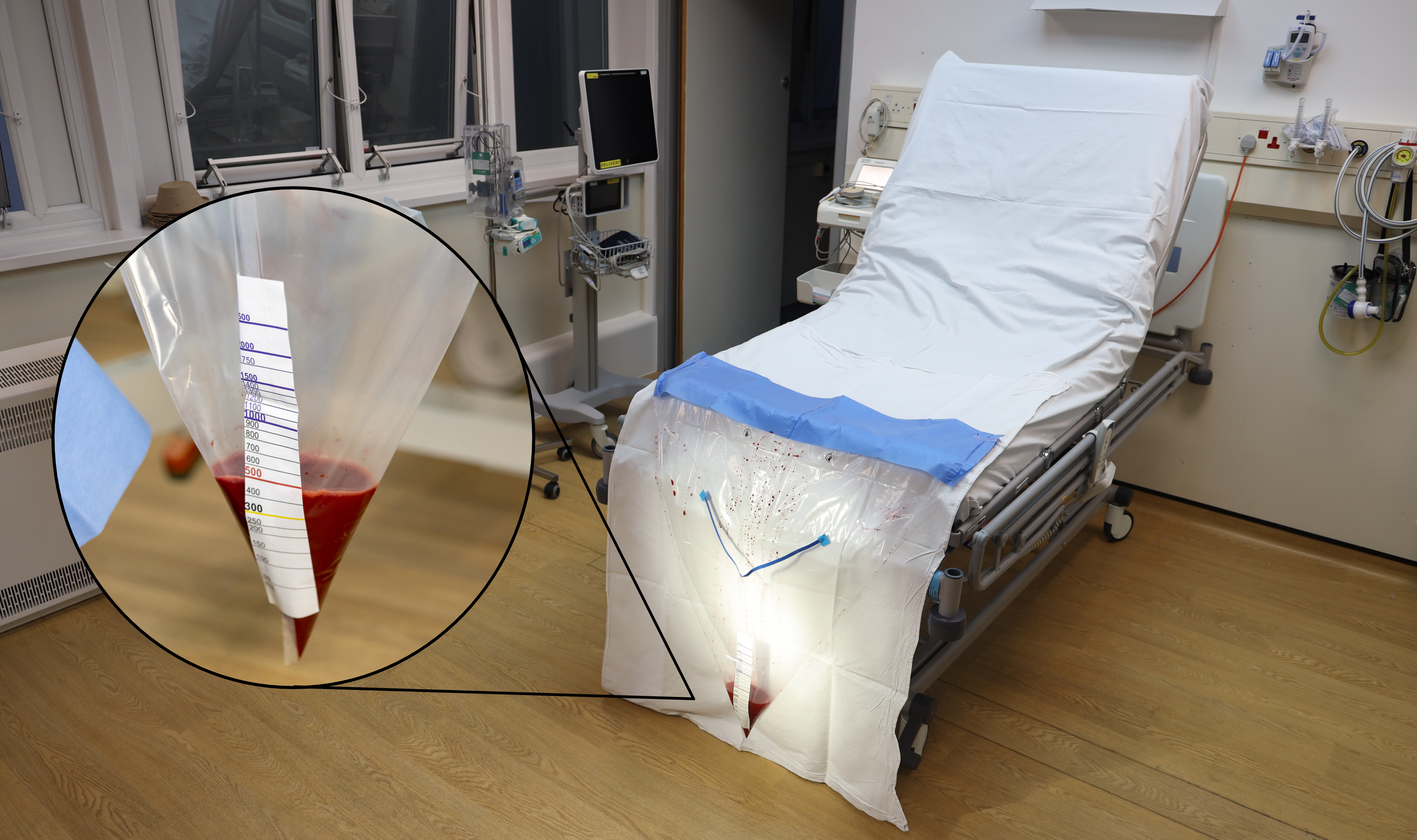 A plastic drape used to measure blood loss from women who have just given birth could save thousands of lives a year